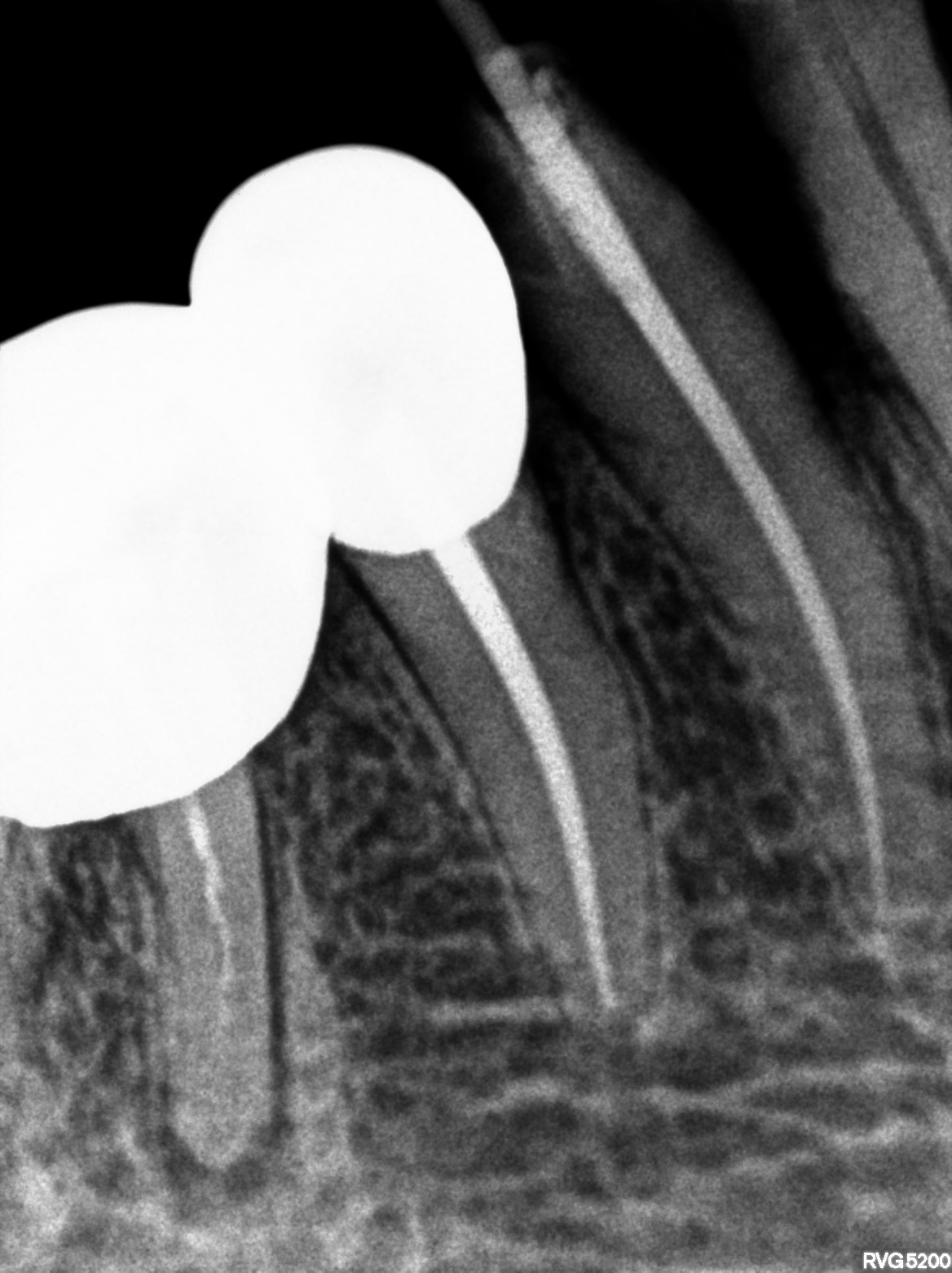 Dental X-ray
